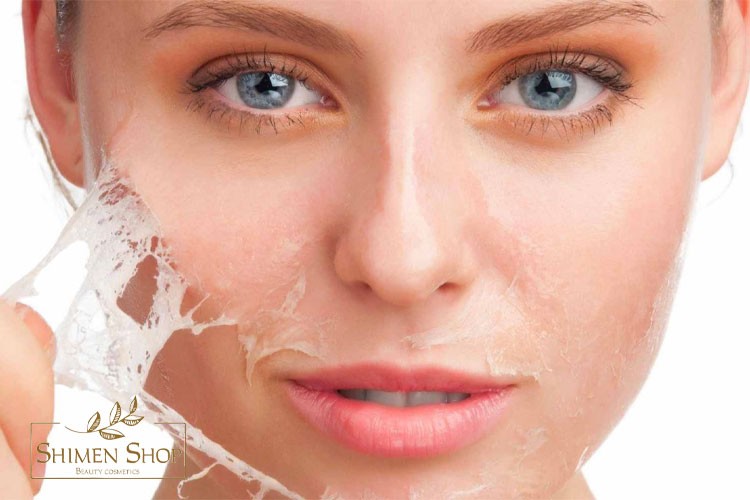 عوارض لایه برداری پوست صورت